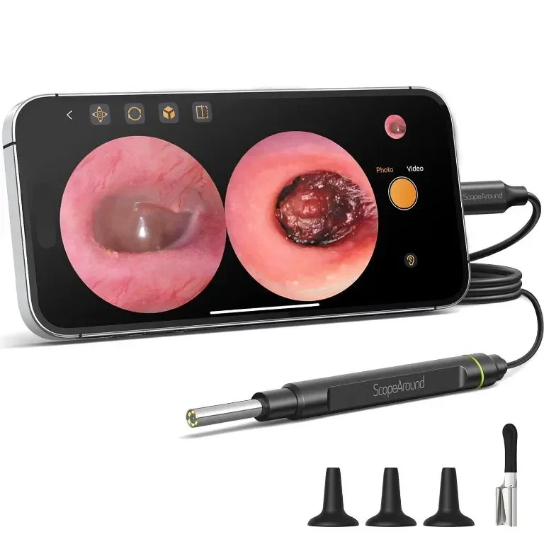 ScopeAround Камера за уши с отоскоп, за отстраняване на ушна кал, съвместим с iPhone 15/ Android