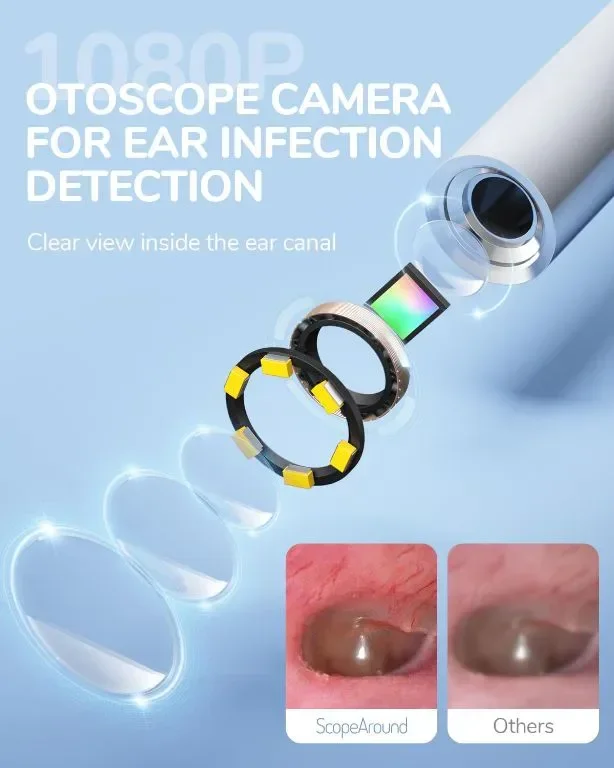 ScopeAround Камера за уши с отоскоп, за отстраняване на ушна кал, съвместим с iPhone 15/ Android — снимка 5