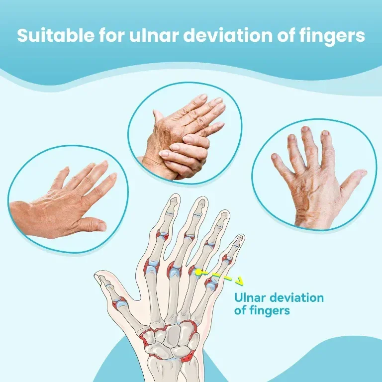 Dr Finger Ортопедична шина за девиация на ставата на пръстите с метална скоба - черна (лява - M) — снимка 2